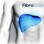 Fibroscan 150x150