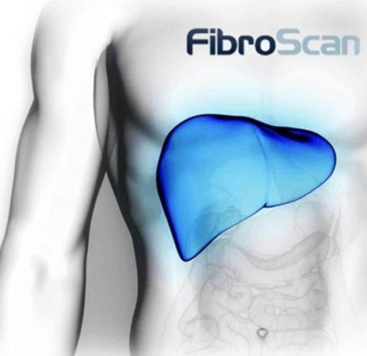 Fibroscan